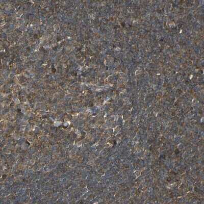 Immunohistochemistry-Paraffin: Caspase-8 Antibody [NBP1-88185]