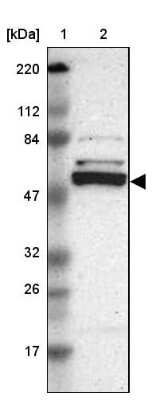 Western Blot: Caspase-8 Antibody [NBP1-88184]