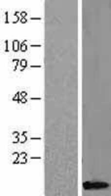 Western Blot: Caspase-8 Overexpression Lysate [NBL1-08717]