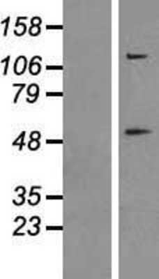 Western Blot: Caspase-8 Overexpression Lysate [NBP2-10964]