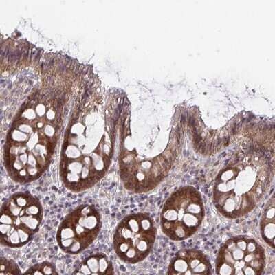 Immunohistochemistry: Caspase-9 Antibody [NBP2-47557]