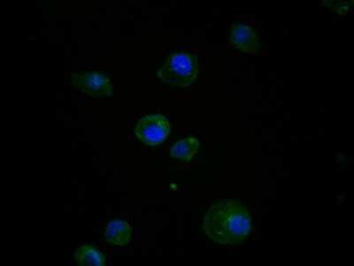 Immunocytochemistry/ Immunofluorescence: Caspase-9 Antibody (SZ29-01) - (Pro and Active) [NBP2-67362]
