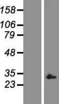 Western Blot: Caspase-9 Overexpression Lysate [NBP2-05935]