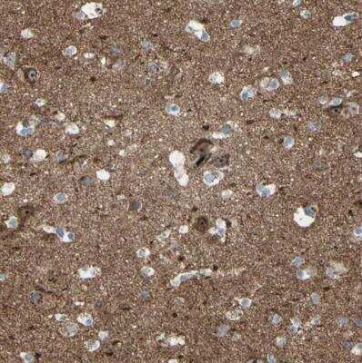 Immunohistochemistry-Paraffin: Caspr1 Antibody [NBP1-88183]