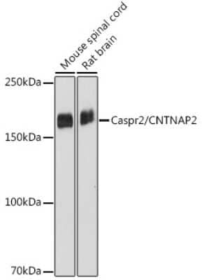 Western Blot: Caspr2 Antibody (2H2I5) [NBP3-15723]