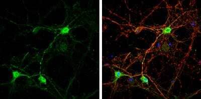 Immunocytochemistry/ Immunofluorescence: Caspr2 Antibody [NBP1-31358]