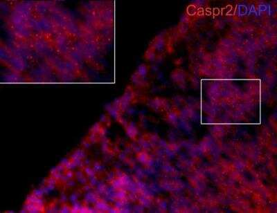 Immunohistochemistry-Frozen: Caspr2 Antibody [NBP1-31358]