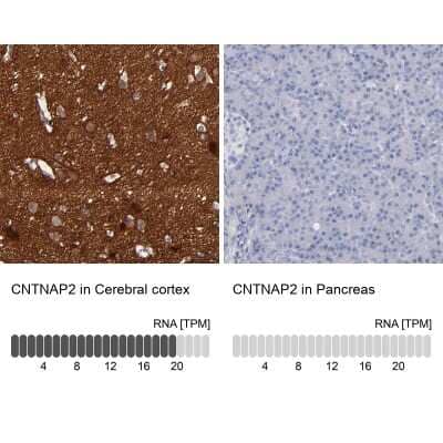 Immunohistochemistry-Paraffin: Caspr2 Antibody [NBP1-88182]