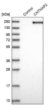 Western Blot: Caspr2 Antibody [NBP1-88182]