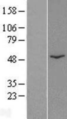 Western Blot: CatSper2 Overexpression Lysate [NBP2-05819]