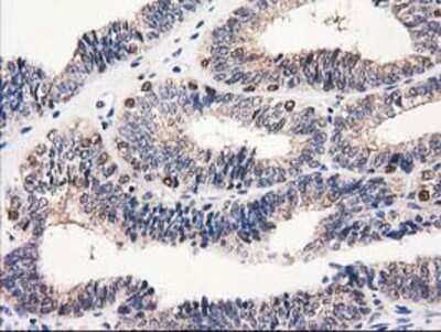Immunohistochemistry-Paraffin: Catalase Antibody (OTI1B8) [NBP2-00492]