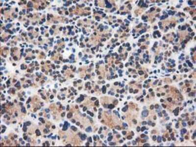 Immunohistochemistry-Paraffin: Catalase Antibody (OTI1B8) [NBP2-00492]