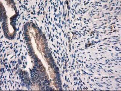 Immunohistochemistry-Paraffin: Catalase Antibody (OTI1B8) [NBP2-00492]