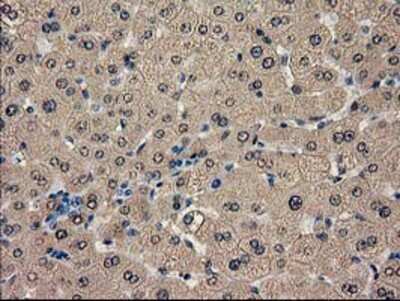 Immunohistochemistry-Paraffin: Catalase Antibody (OTI1B8) [NBP2-00492]