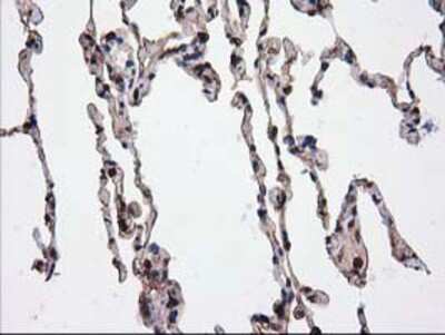 Immunohistochemistry-Paraffin: Catalase Antibody (OTI1B8) [NBP2-00492]