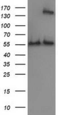 Western Blot: Catalase Antibody (OTI1B8) [NBP2-00492]