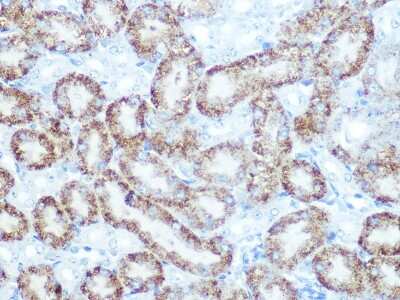 Immunohistochemistry-Paraffin: Catalase Antibody (7D2Y4) [NBP3-15357]