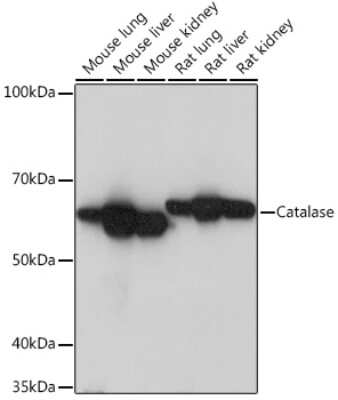 Western Blot: Catalase Antibody (7D2Y4) [NBP3-15357]