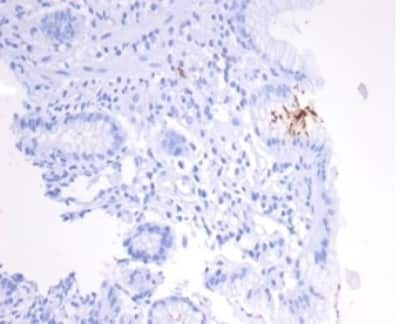 Immunohistochemistry-Paraffin: Catalase Antibody (HPYL/7170) - (H. pylori) [NBP3-13821]