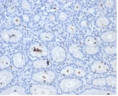 Immunohistochemistry-Paraffin: Catalase Antibody (HPYL/7171) - (H. pylori) [NBP3-13822]