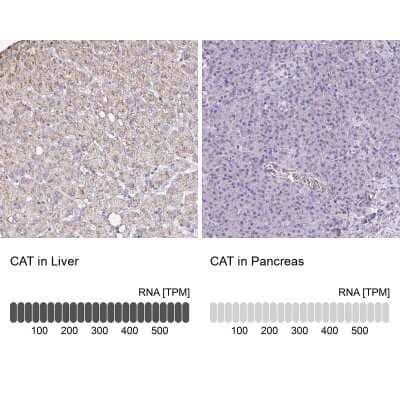 Immunohistochemistry-Paraffin: Catalase Antibody [NBP2-38646]