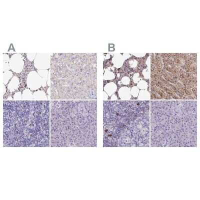 Immunohistochemistry-Paraffin: Catalase Antibody [NBP2-38646]