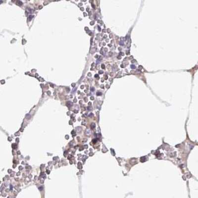 Immunohistochemistry-Paraffin: Catalase Antibody [NBP2-38646]