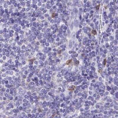 Immunohistochemistry-Paraffin: Catalase Antibody [NBP2-38646]