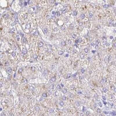 Immunohistochemistry-Paraffin: Catalase Antibody [NBP2-38646]