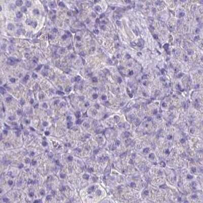 Immunohistochemistry-Paraffin: Catalase Antibody [NBP2-38646]