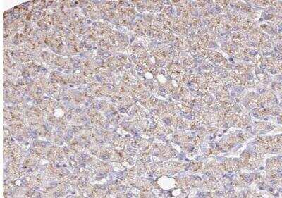 Immunohistochemistry-Paraffin: Catalase Antibody [NBP2-38646]