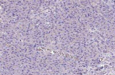 Immunohistochemistry-Paraffin: Catalase Antibody [NBP2-38646]