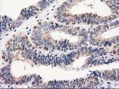 Immunohistochemistry: Catalase Antibody (OTI1B8) - Azide and BSA Free [NBP2-70342]