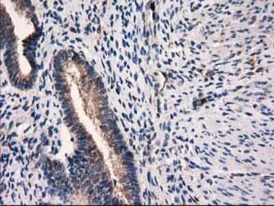Immunohistochemistry: Catalase Antibody (OTI1B8) - Azide and BSA Free [NBP2-70342]