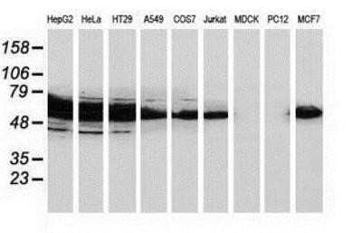 Western Blot: Catalase Antibody (OTI1B8)Azide and BSA Free [NBP2-70342]
