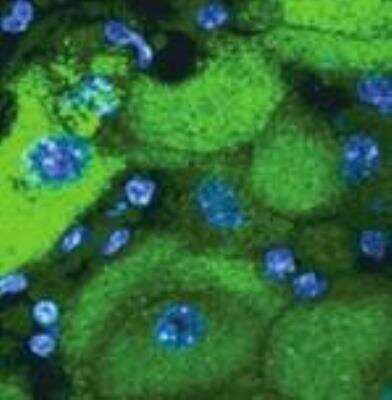 Immunocytochemistry/ Immunofluorescence: Catalase Antibody (OTI1B8) [NBP2-00492]