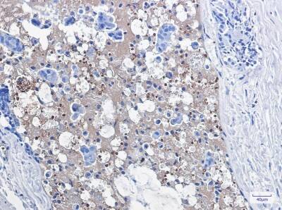Immunohistochemistry-Paraffin: Catalase Antibody (S01-8B2) [NBP3-19593]
