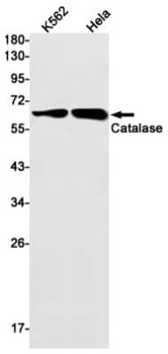 Western Blot: Catalase Antibody (S01-8B2) [NBP3-19593]