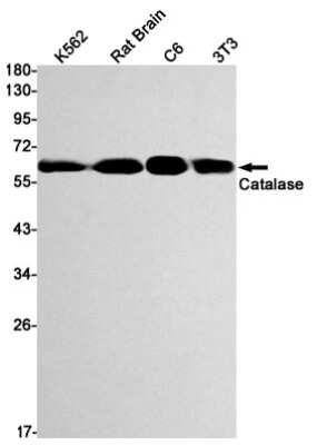 Western Blot: Catalase Antibody (S03-8E9) [NBP3-14914]