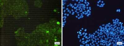 Immunocytochemistry/ Immunofluorescence: Catalase Antibody (S05-5D9) [NBP3-14915]