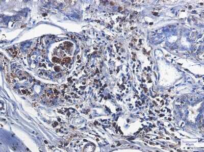 Immunohistochemistry-Paraffin: Catalase Antibody (S05-5D9) [NBP3-14915]