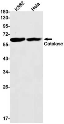 Western Blot: Catalase Antibody (S05-5D9) [NBP3-14915]