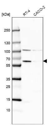 Western Blot: Catalase Antibody [NBP2-38646]