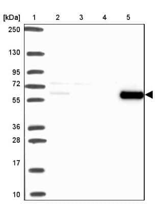 Western Blot: Catalase Antibody [NBP2-38772]