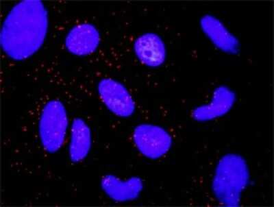 Proximity Ligation Assay: Catenin alpha 1 Antibody (4G6) [H00001495-M03]