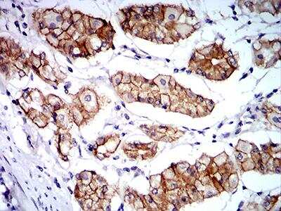 Immunohistochemistry-Paraffin: Catenin alpha 1 Antibody (8B6C1) - BSA Free [NBP2-61722]