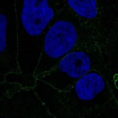 Immunocytochemistry/ Immunofluorescence: Catenin alpha 1 Antibody [NBP2-33456]