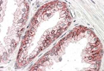 Immunohistochemistry-Paraffin: Catenin alpha 1 Antibody [NB100-2917]