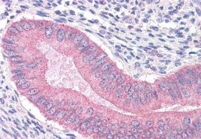 Immunohistochemistry-Paraffin: Catenin alpha 1 Antibody [NB100-2917]