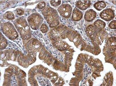 Immunohistochemistry-Paraffin: Catenin alpha 1 Antibody [NBP2-15723]